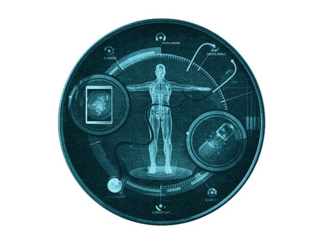 xray