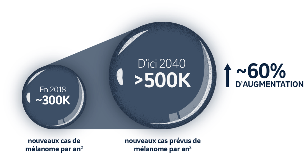 L'incidence mondiale du mélanome augmente rapidement