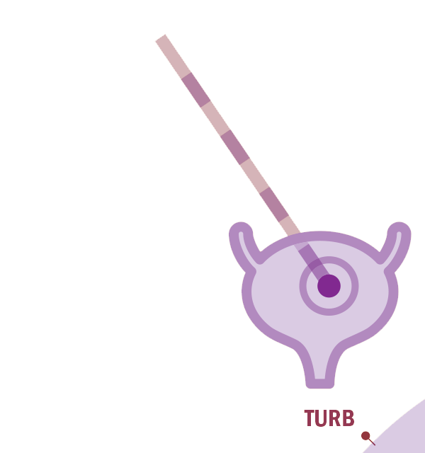 TURB
